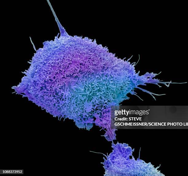 cervical cancer cell, sem - henrietta lacks stock pictures, royalty-free photos & images