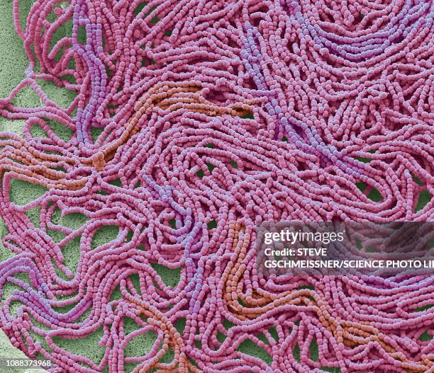 sputum culture, sem - streptococcus stock-fotos und bilder