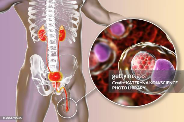 chlamydia infection, illustration - chlamydia trachomatis stock illustrations