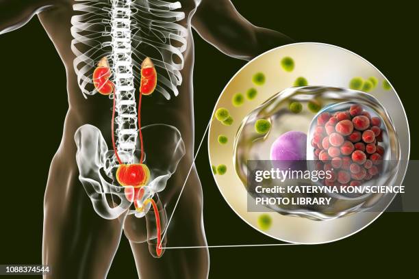chlamydia infection, illustration - cervical screening stock illustrations