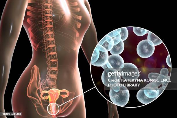 candida albicans infection in female, illustration - symbiotic relationship stock illustrations
