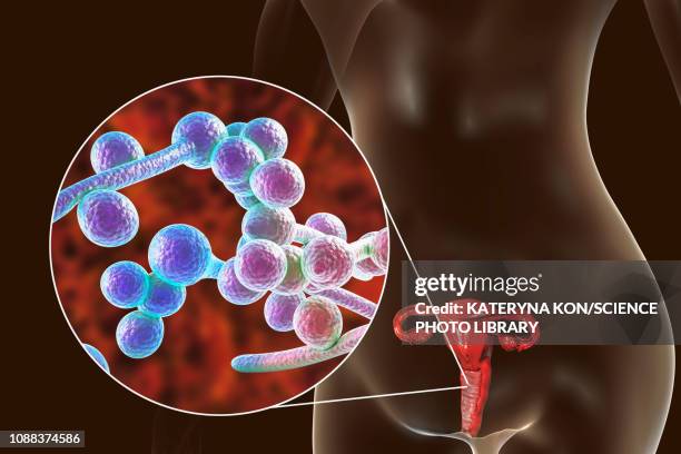illustrations, cliparts, dessins animés et icônes de candida albicans infection in female, illustration - commensalisme