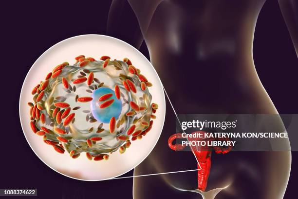 bacterial vaginosis, illustration - cervical screening stock illustrations