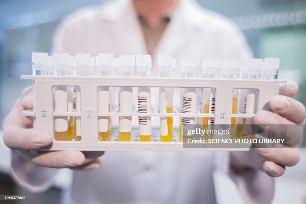 Laboratory assistant holding medical samples