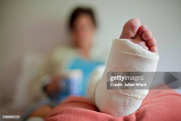 woman lying on a bed with a broken leg - broken leg stock pictures, royalty-free photos & images