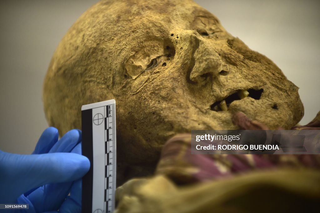 ECUADOR-SCIENCE-MUMMY