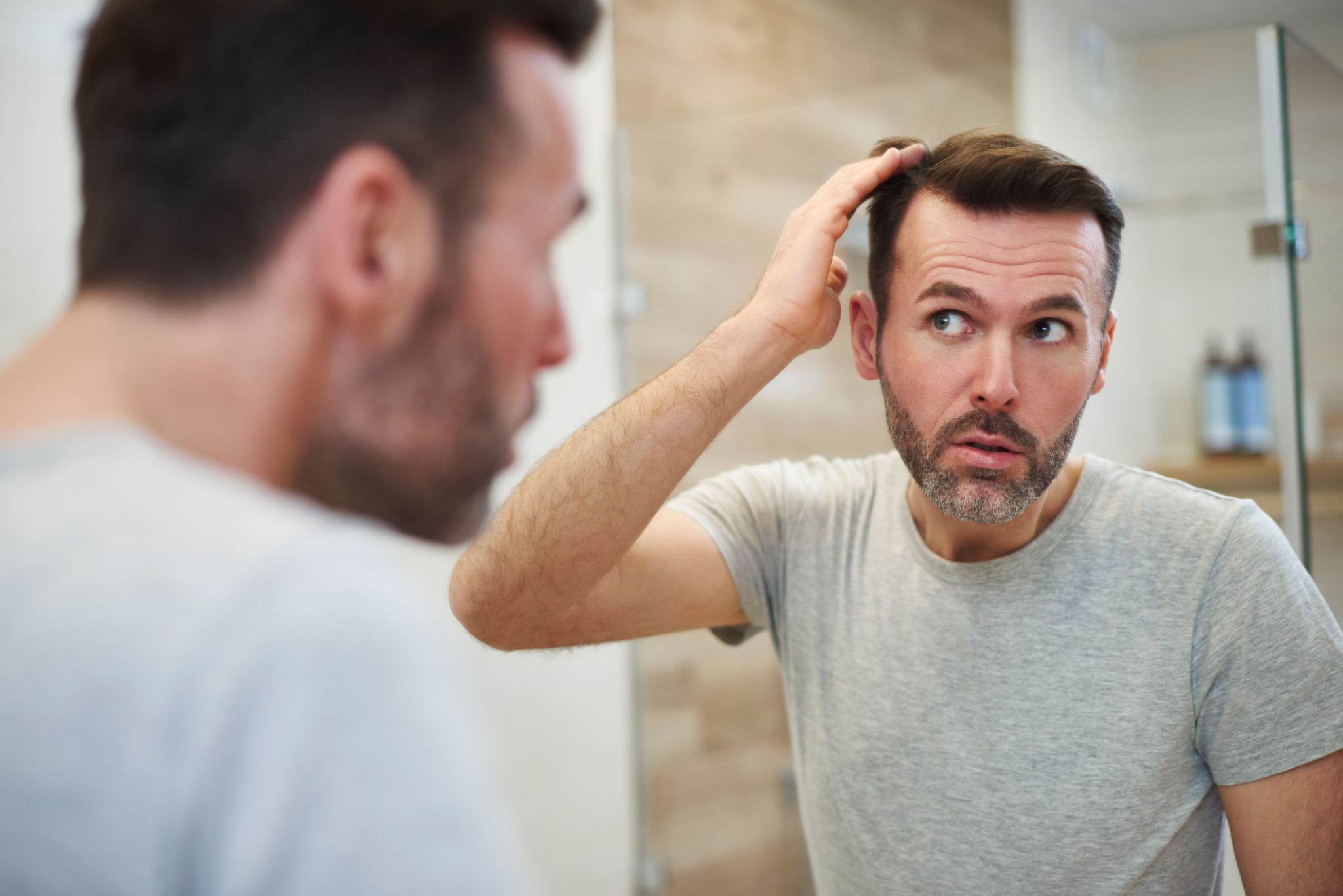 Homens maduros está preocupado com a perda de cabelo Homens maduros está preocupado com a perda de cabelo