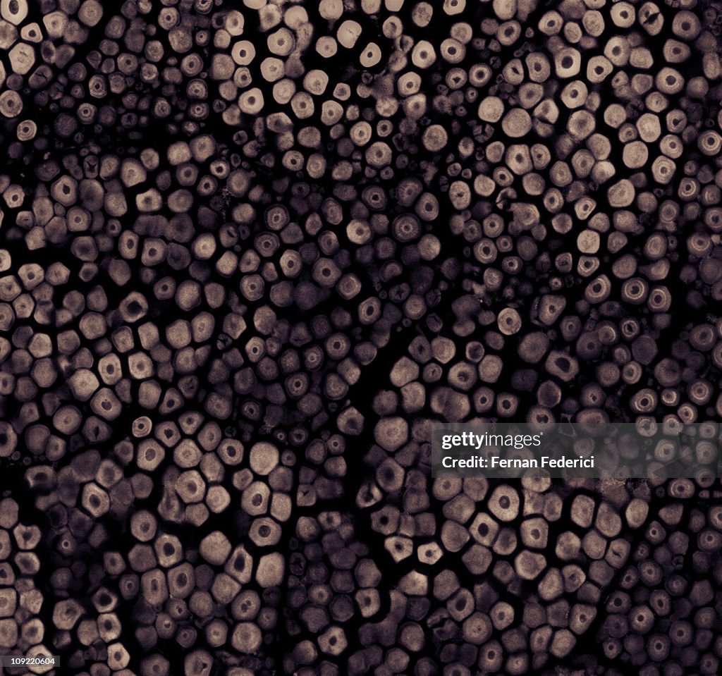 Confocal microscopy of plant cells