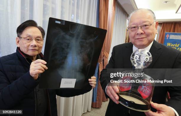 Mr. Steve Lan , Board Chairman, Hong Kong Tuberculosis, Chest and Heart Diseases Association holds a model of a pair of lungs, and Dr Chan Shiu-lun,...