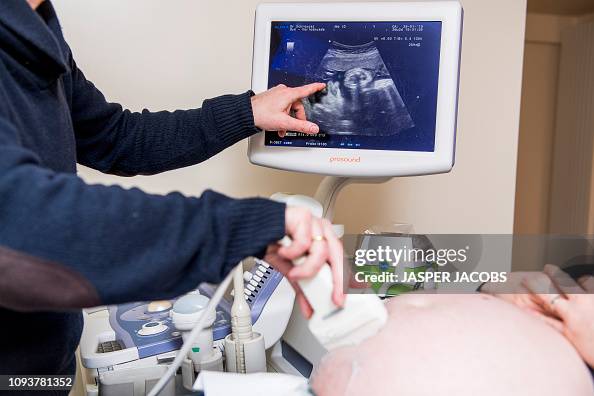 MECHELEN ILLUSTRATIONS PREGNANCY GYNAECOLOGIST MECHELEN ILLUSTRATIONS PREGNANCY GYNAECOLOGIST