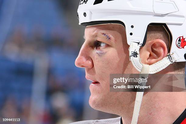 172 Francis Lessard Photos & High Res Pictures - Getty Images