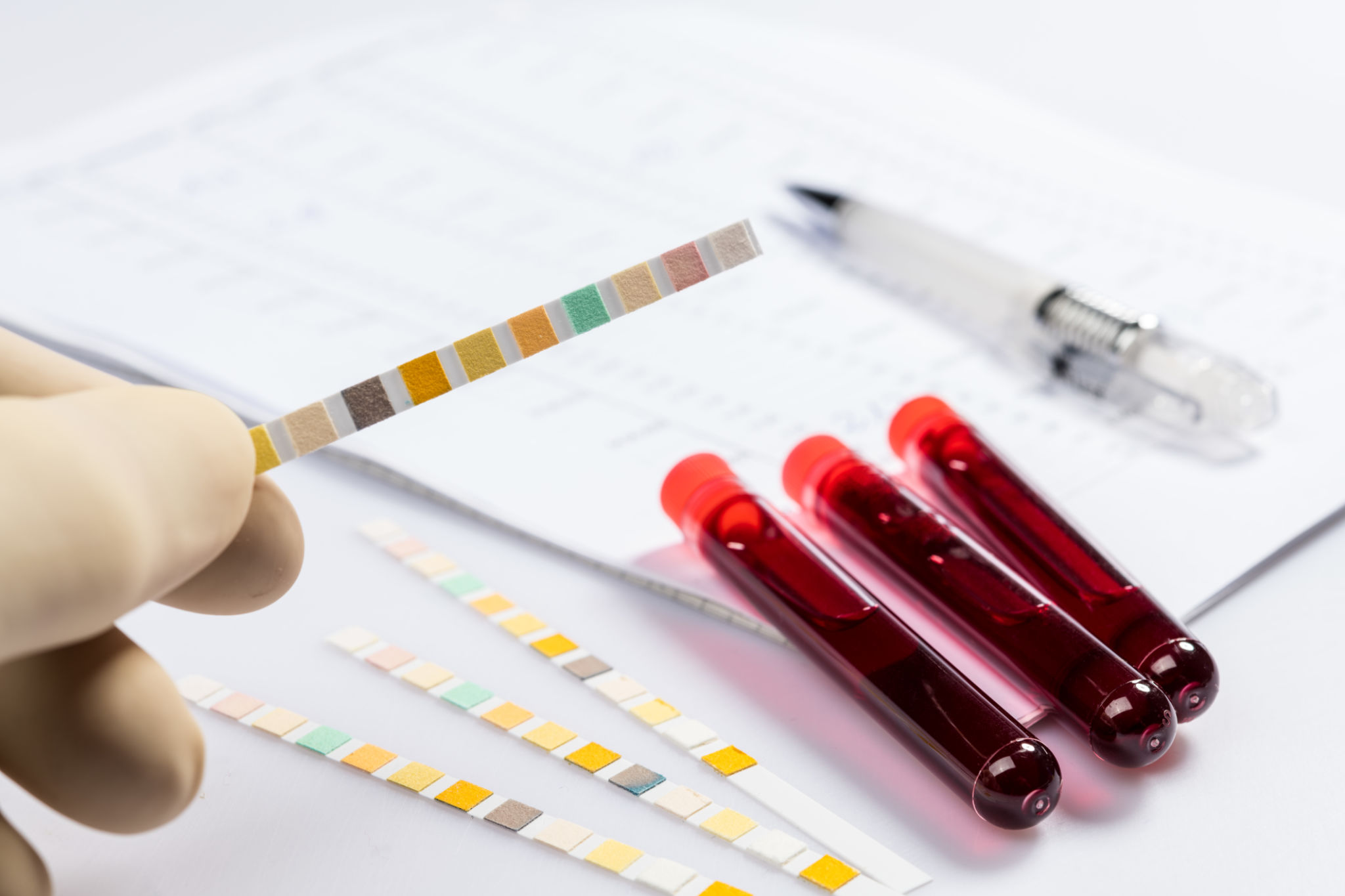 drug testing methods