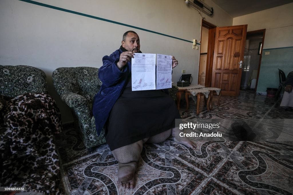 Palestinian man with lymphedema waits for treatment