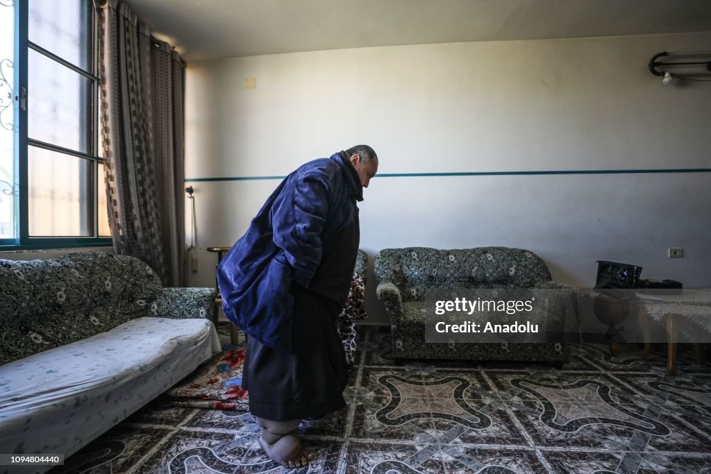 Palestinian man with lymphedema