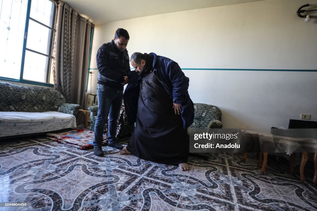 Palestinian man with lymphedema