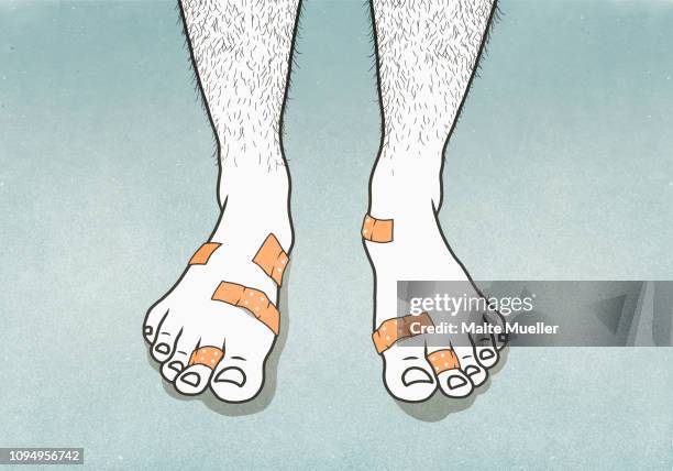 bandages covering blisters on mans feet - bandage stock illustrations