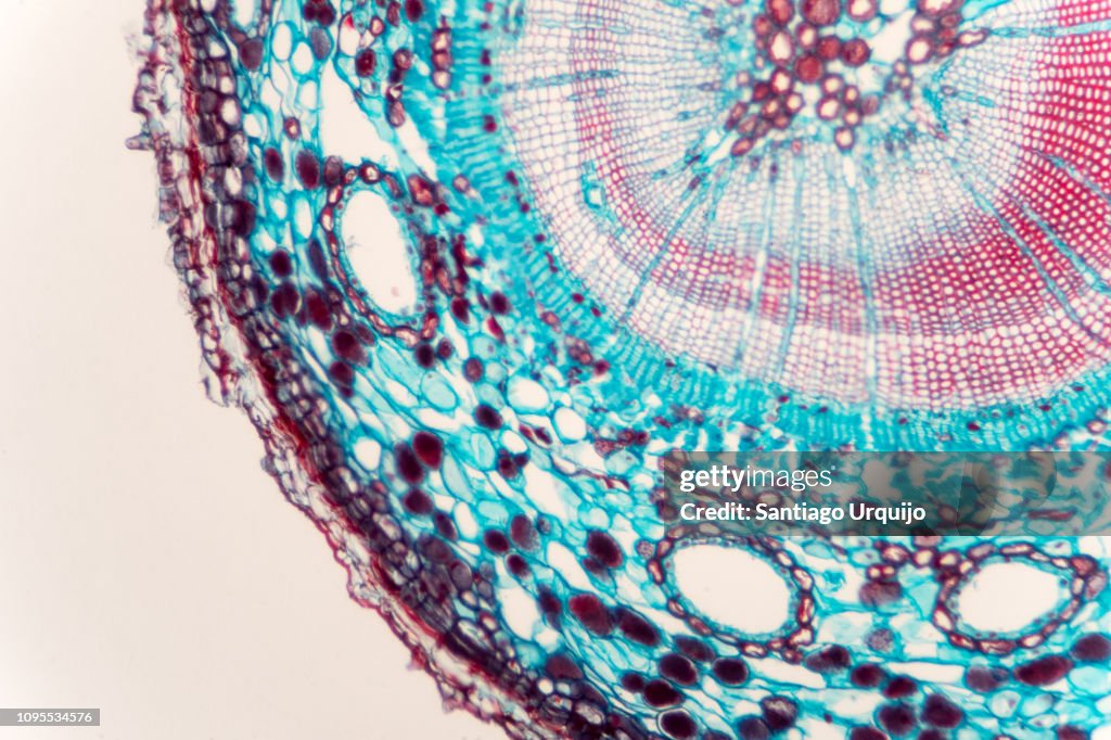 Microscopic view of stem of wood dicotyledon