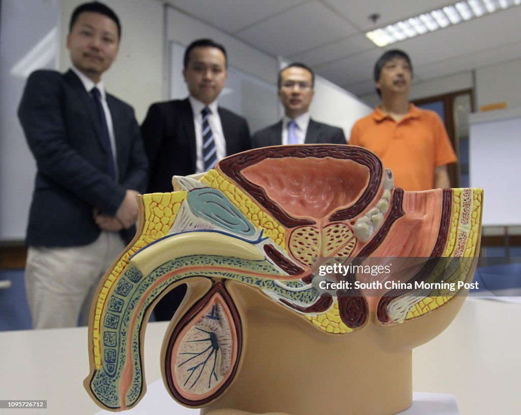 (L to R) Alan Ng, Cancer information; Dr. Darren Poon , department of Clinical Oncology, CUHK; Dr NG Chi Fai, Professor of Division of Urology, Department of Surgery,CUHK and prostate cancer patients Lee Wing-chuen attend a press conference of finding on