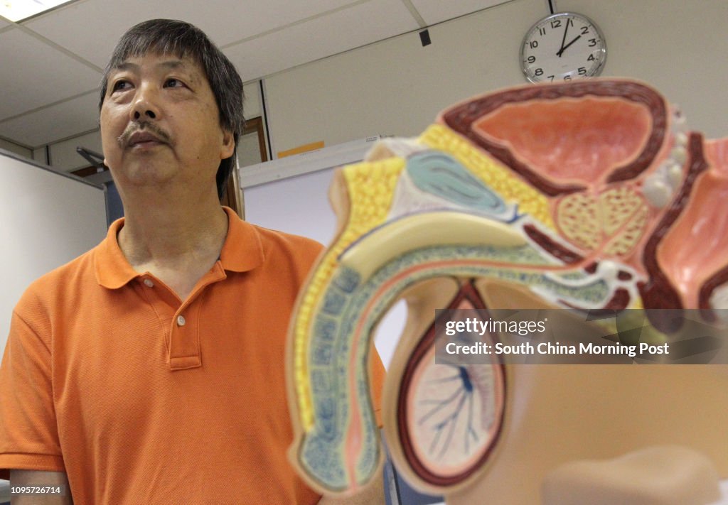 Prostate cancer patients Lee Wing-chuen attends a press conference of finding on combining hormone therapy with chemotherapy could extend the life of prostate cancer patients, Scout Association of Hong Kong, TST. 15JUN15