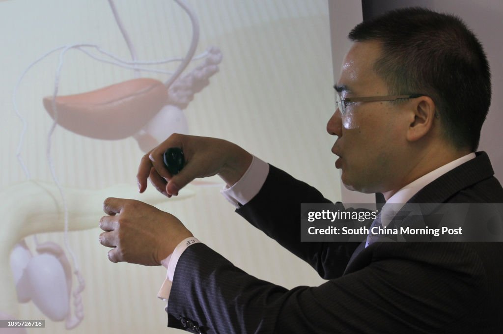 Dr NG Chi-fai, Professor of Division of Urology, Department of Surgery,CUHK attends a press conference of finding on combining hormone therapy with chemotherapy could extend the life of prostate cancer patients, Scout Association of Hong Kong, TST. 15JUN
