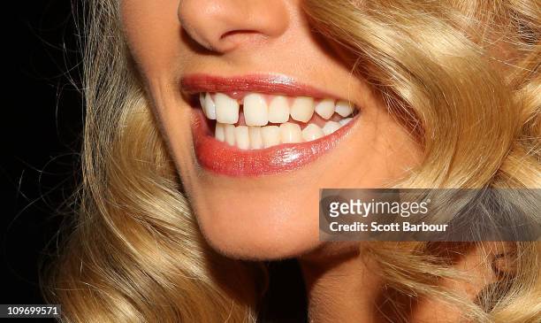 The teeth of model Jessica Hart are seen as she arrives at the Myer Autumn/Winter Season Launch 2011 at The Royal Exhibition Building on March 1,...