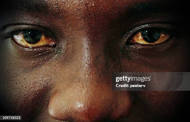 bloodshot eyes - red eyes stock pictures, royalty-free photos & images