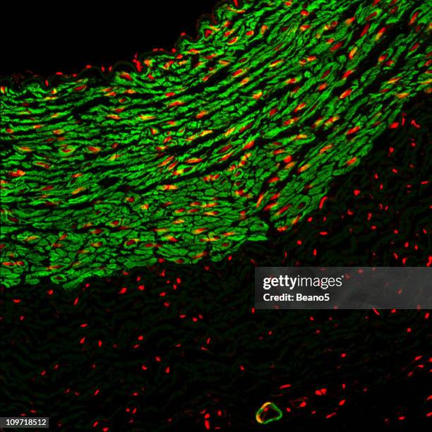 immunofluorescence éosine - microphotographie immunofluorescente photos et images de collection