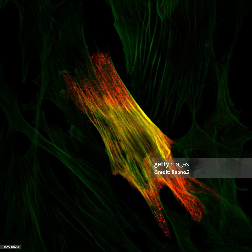 Immunoflourescence of a smooth muscle cell