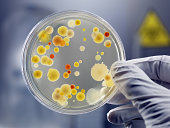 Gloved Hand Holding Petri Dish with Bacteria Culture