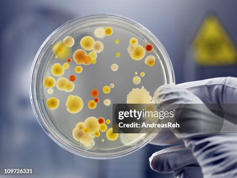 Gloved Hand Holding Petri Dish with Bacteria Culture Gloved Hand Holding Petri Dish with Bacteria Culture