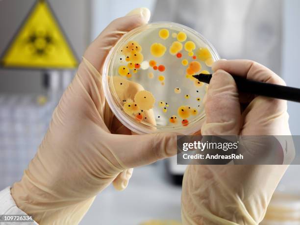 bacteria density counting - agar jelly stock pictures, royalty-free photos & images