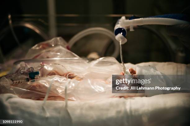 29 week premature baby immediately after birth intubated - critical care stock pictures, royalty-free photos & images