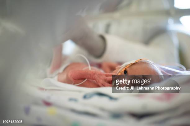 29 week premature baby with eyes open and feeding tube in nicu - premature baby incubator stock-fotos und bilder