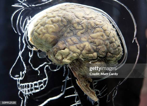 Real human brain being displayed as part of new exhibition at the @Bristol attraction is seen on March 8, 2011 in Bristol, England. The Real Brain...