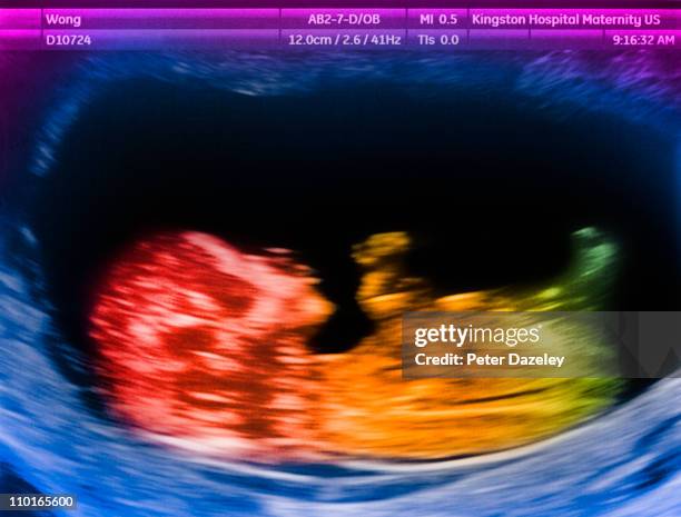 12 week old baby scan - foetus stock pictures, royalty-free photos & images