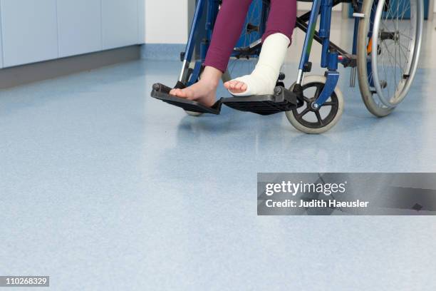 foot in plaster, feet in wheelchair - leg cast hospital stock pictures, royalty-free photos & images