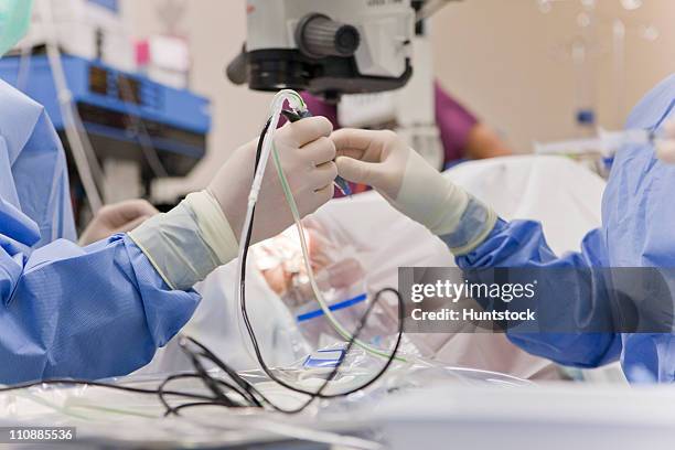 doctor passing phaco hand piece to technologist during cataract surgery - operating machine stock pictures, royalty-free photos & images