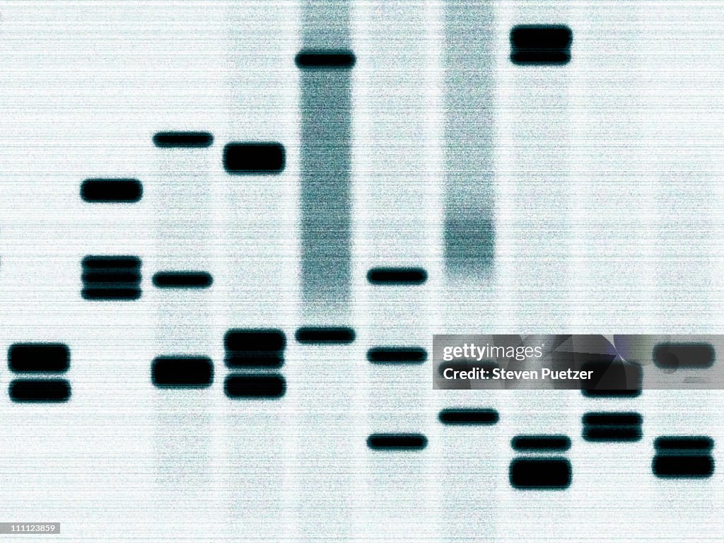 Dna Example Gel Dna Sequencing Gel High-Res Stock Photo - Getty Images