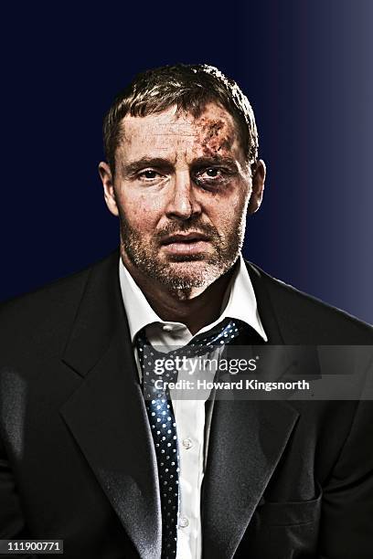 bruised businessman looking to camera - blaues auge stock-fotos und bilder