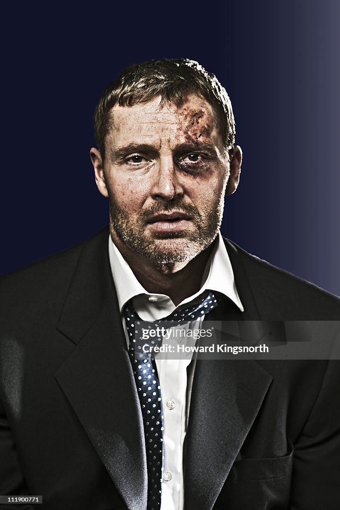 Bruised businessman looking to camera