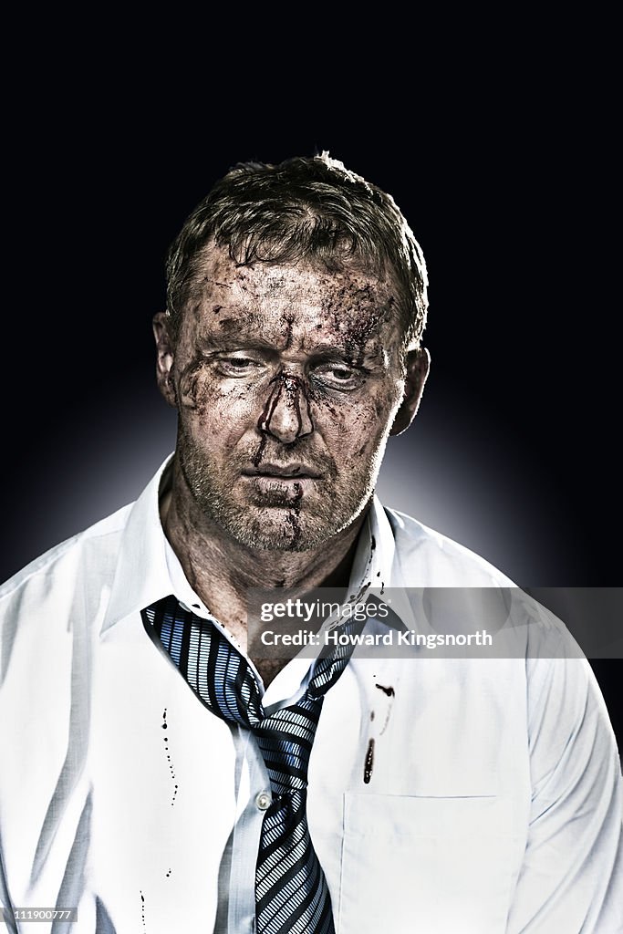 Beaten and bruised businessman