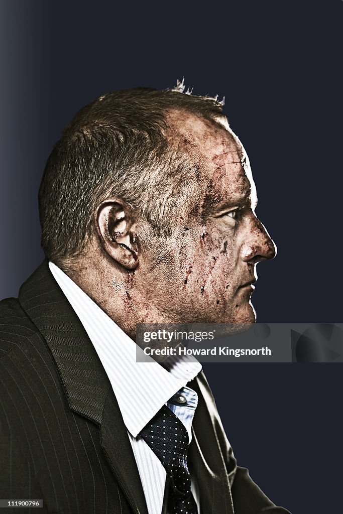 Businessman with bruised and bloody face