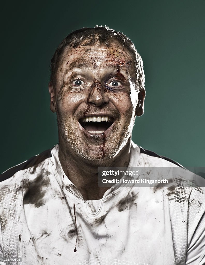 Bruised sportsman laughing to camera