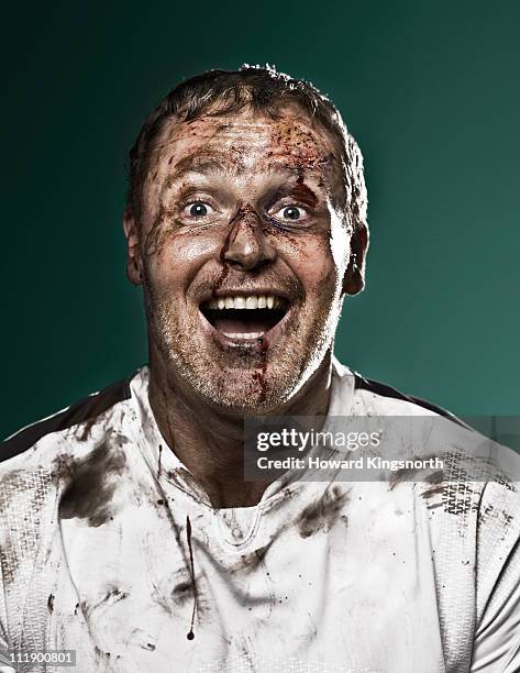 bruised sportsman laughing to camera - beaten up stockfoto's en -beelden