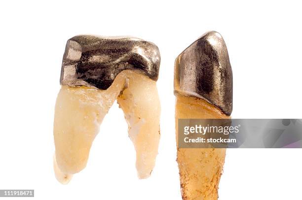 human teeth with gold crown, isolated - gold crown stock pictures, royalty-free photos & images