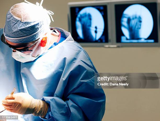 orthopedic surgeon operating on foot. - orthopedic surgeon stock pictures, royalty-free photos & images