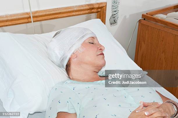 hospital patient sleeping - head bandage stock pictures, royalty-free photos & images