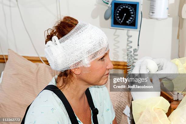 healthcare: hospital patient with injury - brain damage stock pictures, royalty-free photos & images