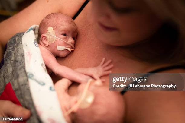 29 week premature twins are held together with skin to skin by mother in hospital in the nicu - prematuro imagens e fotografias de stock