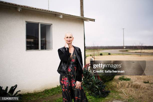 portrait of a woman with alopecia in a dress - tough love stock pictures, royalty-free photos & images